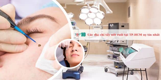 Các địa chỉ tẩy nốt ruồi tại TP.HCM uy tín nhất