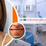 Các địa chỉ phẫu thuật cười hở lợi tại TPHCM uy tín nhất