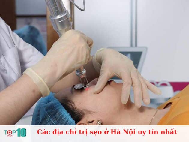 Các địa chỉ trị sẹo ở Hà Nội uy tín nhất