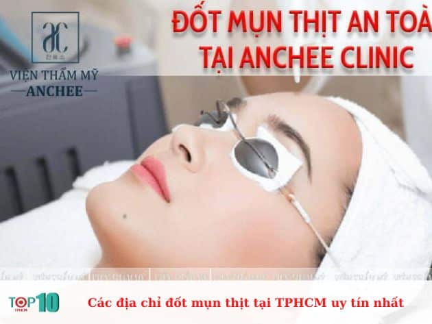 Các địa chỉ đốt mụn thịt tại TPHCM uy tín nhất