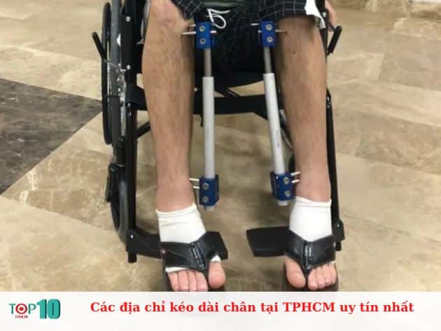 Các địa chỉ kéo dài chân tại TPHCM uy tín nhất