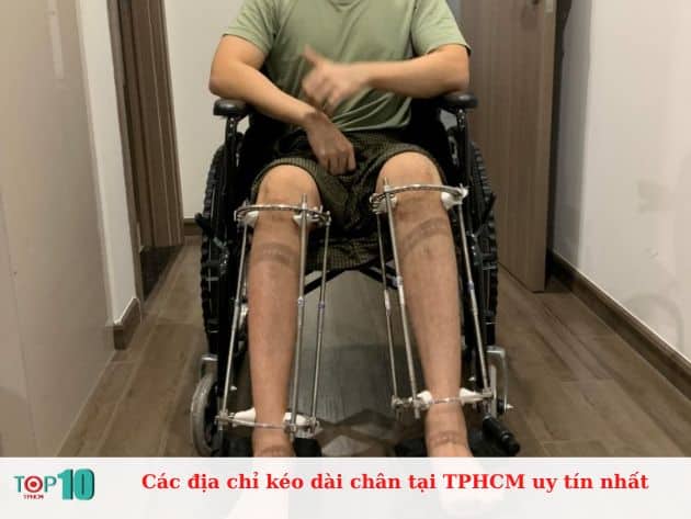 Các địa chỉ kéo dài chân tại TPHCM uy tín nhất