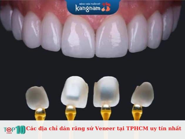 Các địa chỉ dán răng sứ Veneer tại TPHCM uy tín nhất