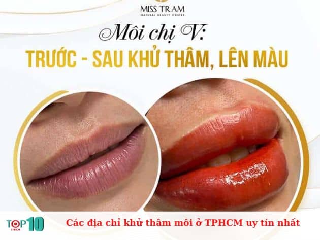 Các địa chỉ khử thâm môi ở TPHCM uy tín nhất