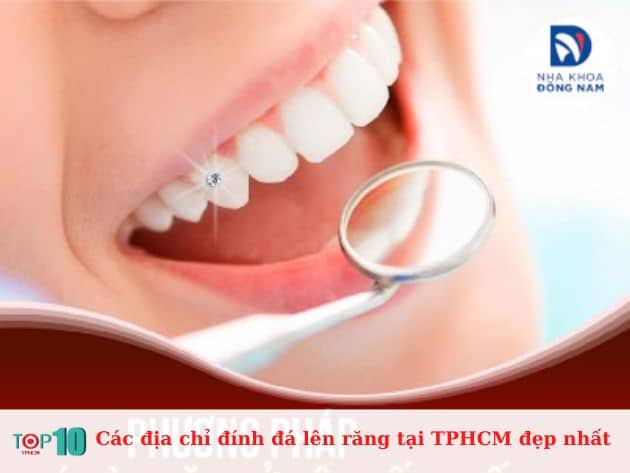 Các địa chỉ đính đá lên răng tại TPHCM đẹp nhất