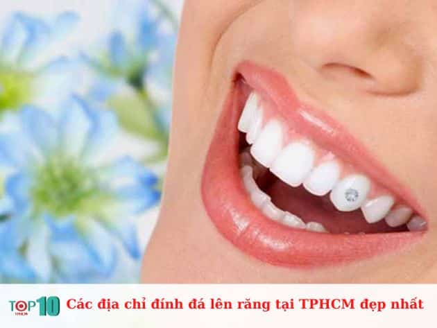 Các địa chỉ đính đá lên răng tại TPHCM đẹp nhất