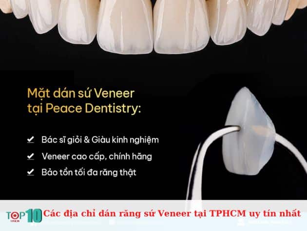 Các địa chỉ dán răng sứ Veneer tại TPHCM uy tín nhất