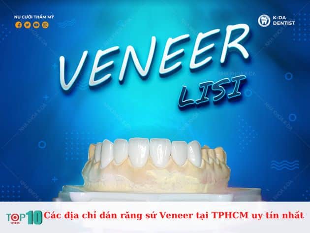 Các địa chỉ dán răng sứ Veneer tại TPHCM uy tín nhất