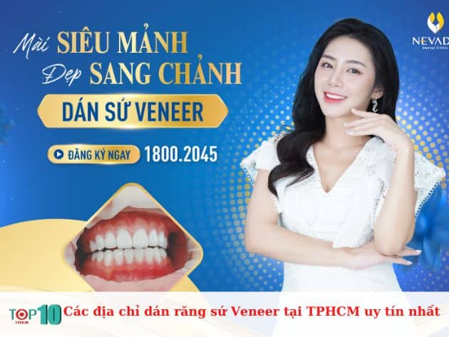 Các địa chỉ dán răng sứ Veneer tại TPHCM uy tín nhất