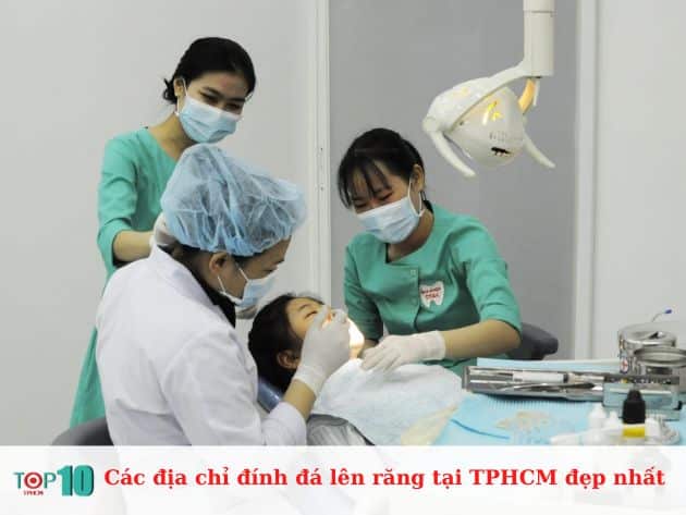 Các địa chỉ đính đá lên răng tại TPHCM đẹp nhất