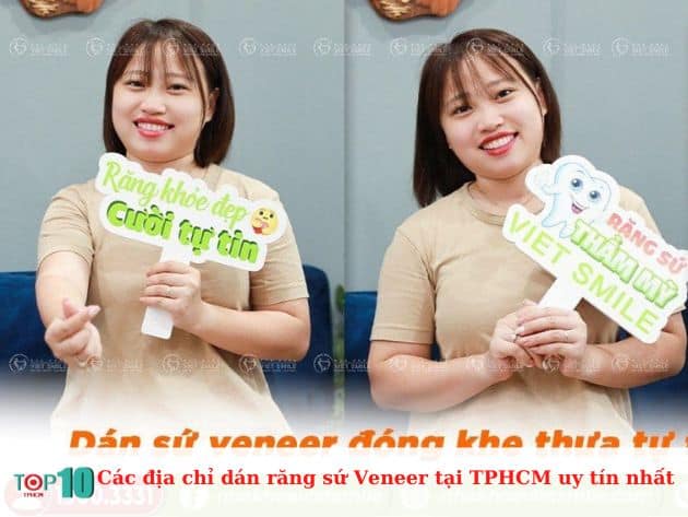 Các địa chỉ dán răng sứ Veneer tại TPHCM uy tín nhất