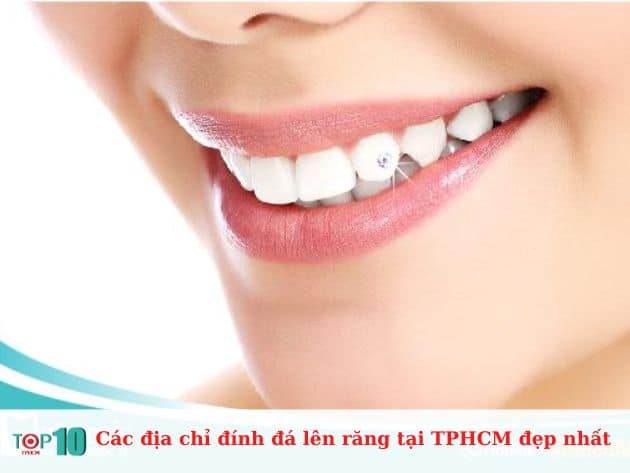 Các địa chỉ đính đá lên răng tại TPHCM đẹp nhất