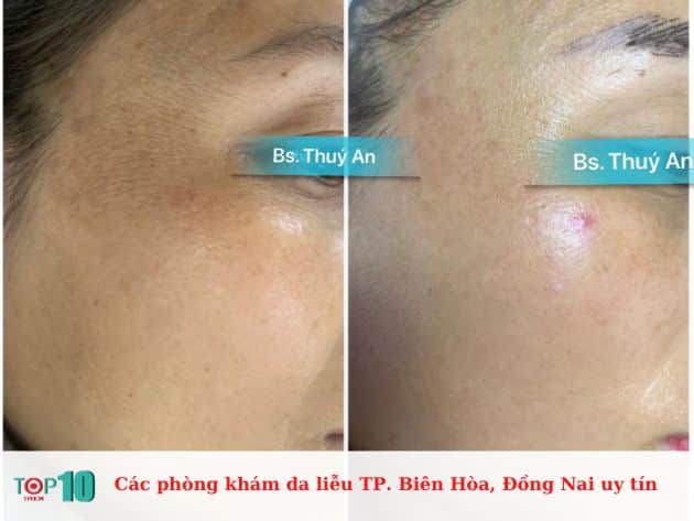 Các phòng khám da liễu TP. Biên Hòa, Đồng Nai uy tín