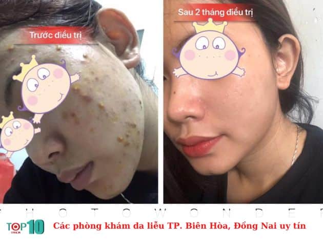 Các phòng khám da liễu TP. Biên Hòa, Đồng Nai uy tín