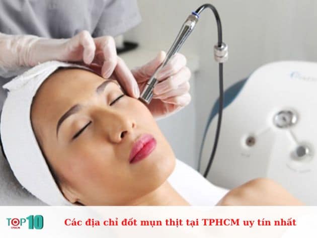 Các địa chỉ đốt mụn thịt tại TPHCM uy tín nhất