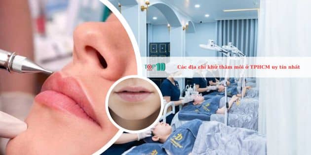 Top 12 Địa chỉ khử thâm môi ở TPHCM hiệu quả, uy tín nhất