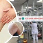 Các địa chỉ điều trị giãn tĩnh mạch tại TPHCM uy tín