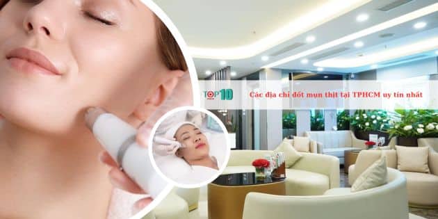 Các địa chỉ đốt mụn thịt tại TPHCM uy tín nhất