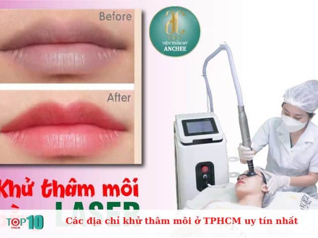 Các địa chỉ khử thâm môi ở TPHCM uy tín nhất