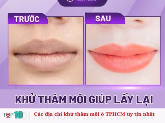 Các địa chỉ khử thâm môi ở TPHCM uy tín nhất