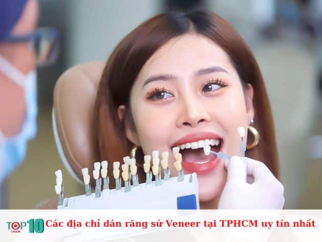 Các địa chỉ dán răng sứ Veneer tại TPHCM uy tín nhất