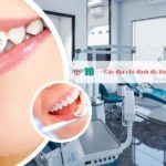 Các địa chỉ đính đá lên răng tại TPHCM đẹp nhất