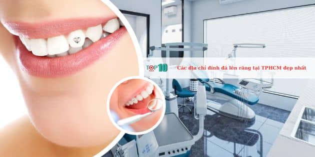 Các địa chỉ đính đá lên răng tại TPHCM đẹp nhất