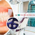 Các địa chỉ làm răng giả ở TPHCM tốt nhất