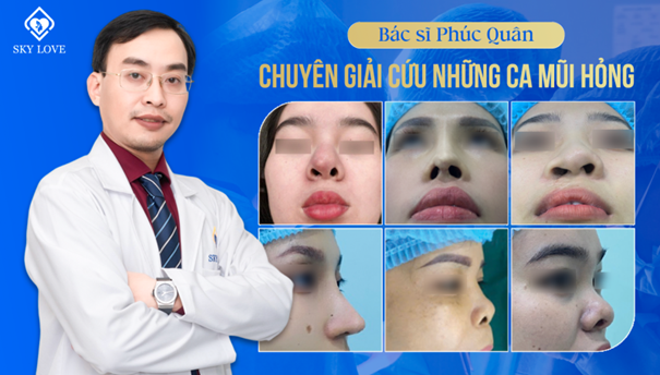 Bác sĩ Phúc Quân - Chuyên gia “giải cứu” những ca mũi hỏng